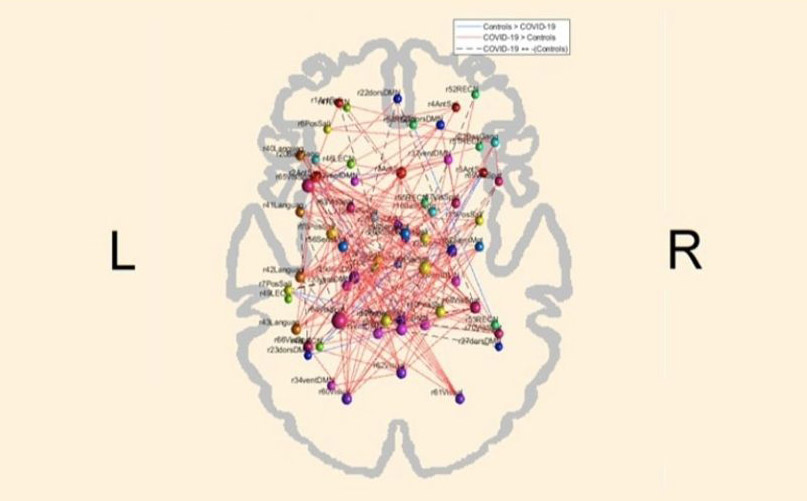 Covid-19 e a conectividade funcional do cérebro