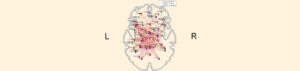 brain with Covid-19