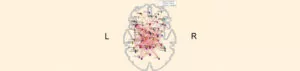 brain with Covid-19