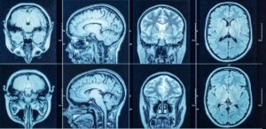 Paternal stress associated with