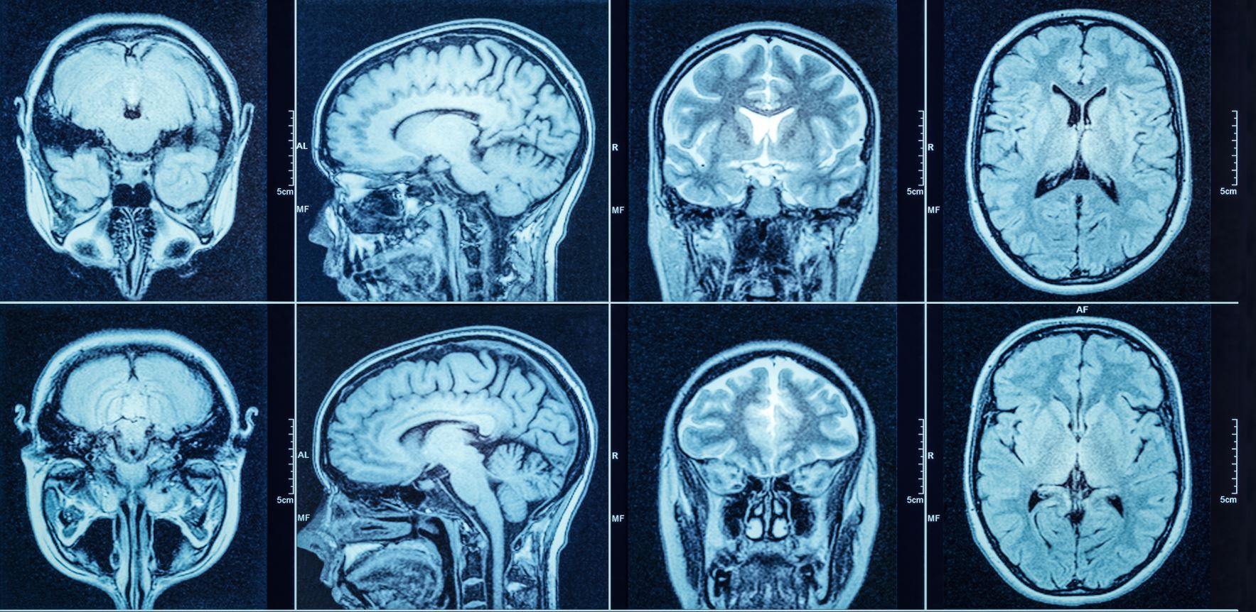 Paternal stress associated with