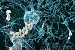 Ligação entre gene comum no Alzheimer e COVID-19