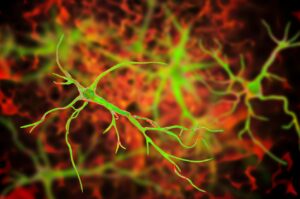 Bipolar Disorder and Neuroinflammation