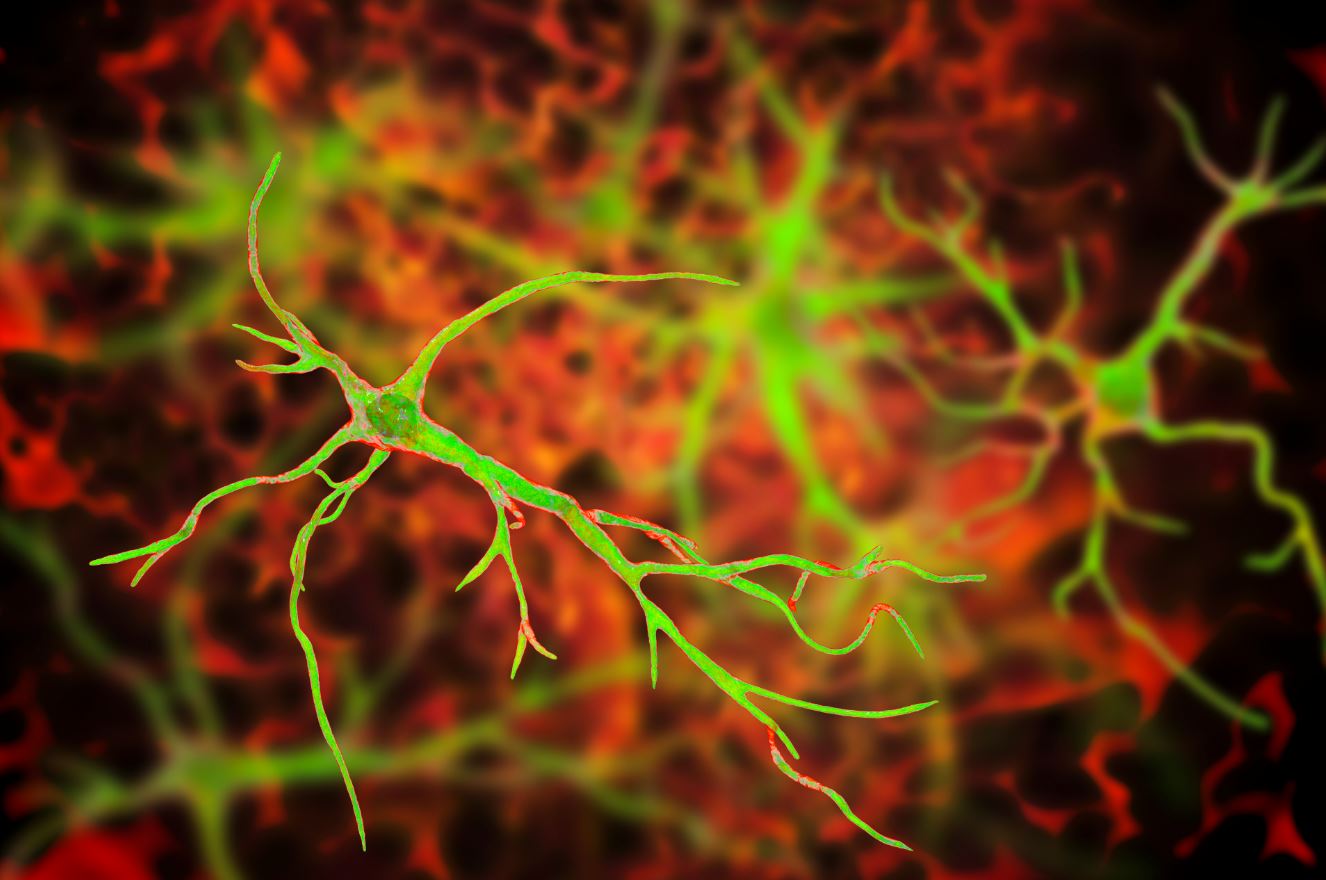 Bipolar Disorder and Neuroinflammation