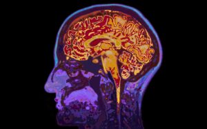 Neuroimaging and brain structure in psychiatric disorders