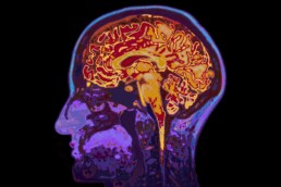 Neuroimagem e estrutura cerebral em transtornos psiquiátricos