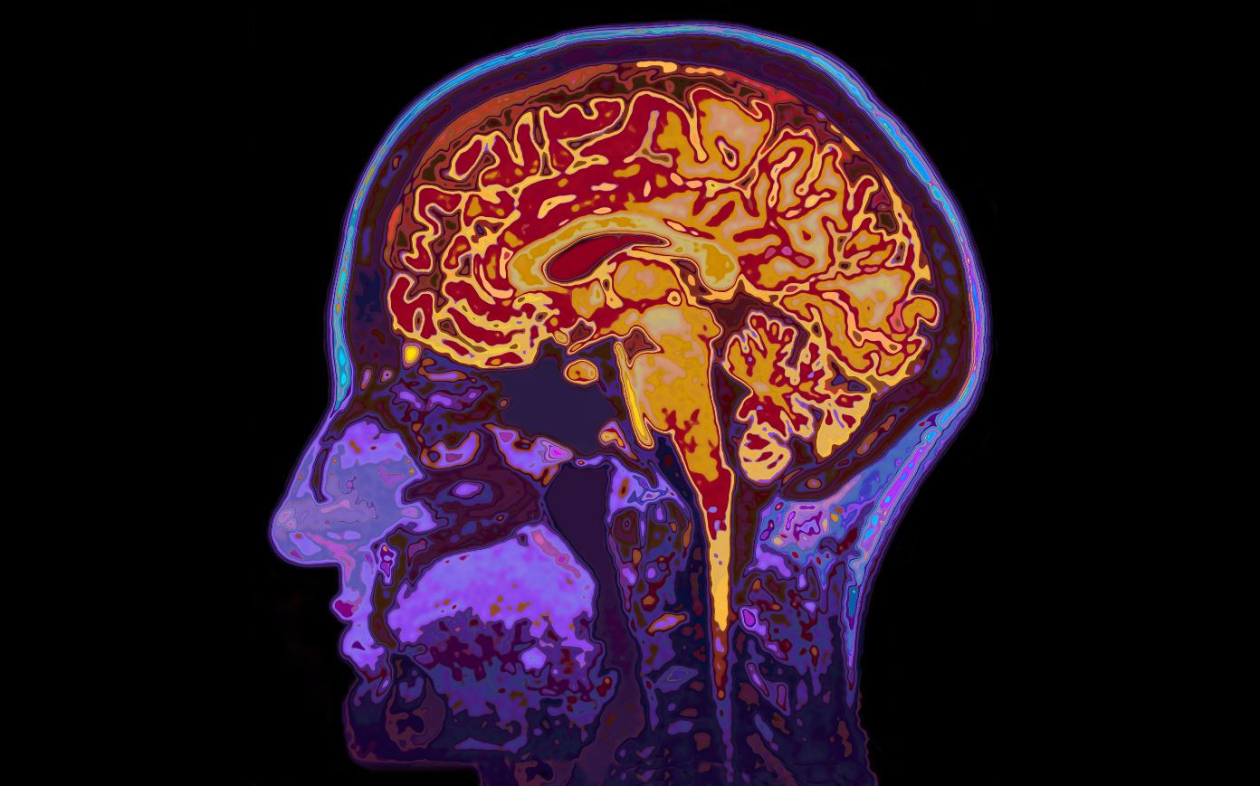 Neuroimagem e estrutura cerebral em transtornos psiquiátricos