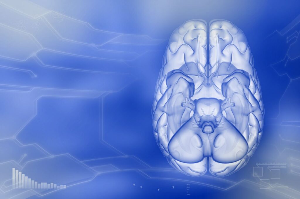 Capsulotomia por Gamma Knife para transtorno obsessivo compulsivo intratável