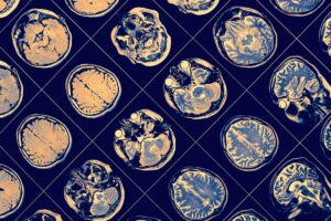 how to choose a good cover psychiatrist