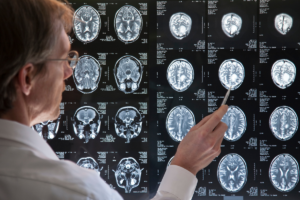 doctor specializing in mental health analyzing ultrasounds